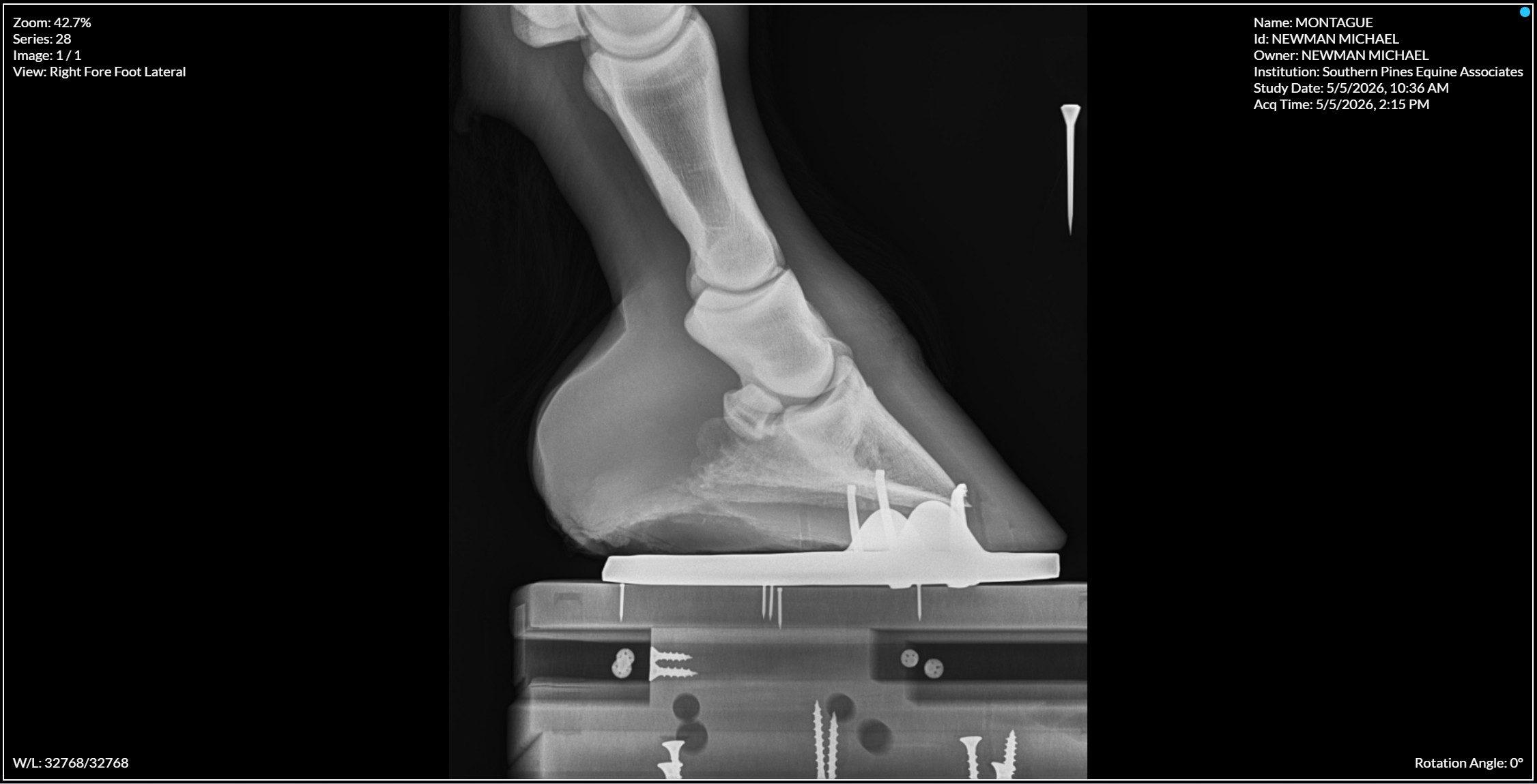 Right Forefoot Lateral